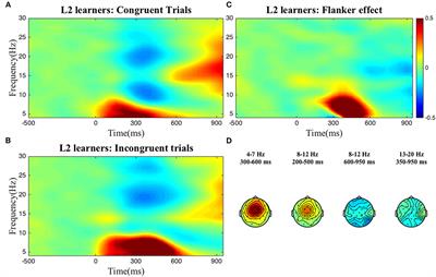 Type of bilingualism conditions individual differences in the oscillatory dynamics of inhibitory control